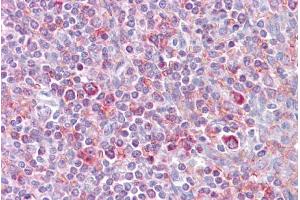 Image no. 1 for anti-V-Rel Reticuloendotheliosis Viral Oncogene Homolog B (RELB) (N-Term) antibody (ABIN2780784)