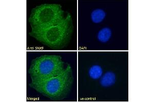 Image no. 2 for anti-Sorting Nexin 9 (SNX9) (Internal Region) antibody (ABIN185590)