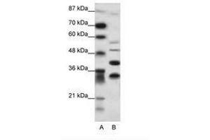 Image no. 1 for anti-Growth Factor Independent 1 (GFI1) (N-Term) antibody (ABIN6736088)