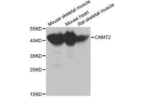Image no. 2 for anti-Cholinergic Receptor, Nicotinic, alpha 7 (Neuronal) (CHRNA7) antibody (ABIN1512763)