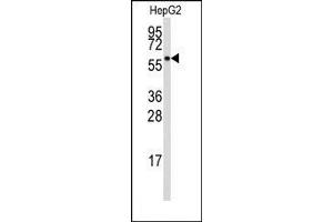 Image no. 1 for anti-Aldehyde Dehydrogenase 3 Family, Member B1 (ALDH3B1) (Middle Region) antibody (ABIN360240)