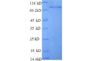 Image no. 1 for Keratin 10 (KRT10) (AA 1-584), (full length) protein (His tag) (ABIN5709823)
