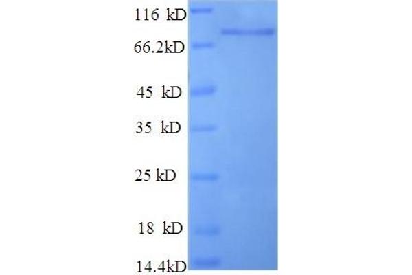 Keratin 10 (KRT10) (AA 1-584), (full length) protein (His tag)