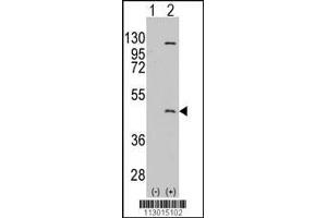 Image no. 2 for anti-Protein Arginine Methyltransferase 8 (PRMT8) (AA 344-373), (C-Term) antibody (ABIN388025)