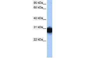 Image no. 2 for anti-Triosephosphate Isomerase 1 (TPI1) (N-Term) antibody (ABIN2783242)