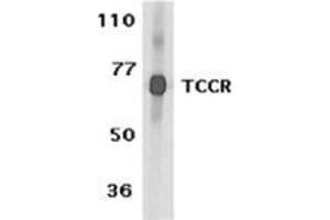 Image no. 2 for anti-Interleukin 27 Receptor, alpha (IL27RA) (N-Term) antibody (ABIN500875)