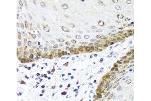 BMP5 antibody