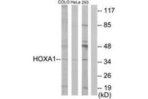 Image no. 1 for anti-Homeobox A1 (HOXA1) (AA 171-220) antibody (ABIN1533745)