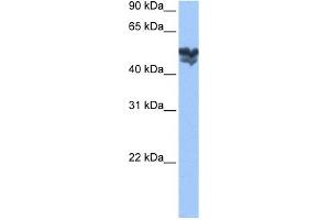 Image no. 1 for anti-WAS Protein Family, Member 3 (WASF3) (Middle Region) antibody (ABIN631249)