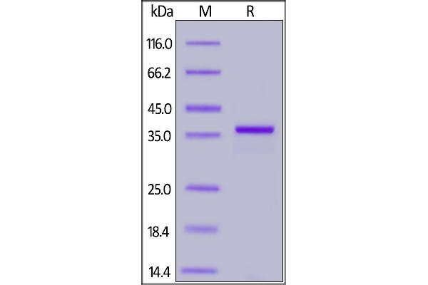 SARS-CoV-2 NSP3 Protein (His tag)