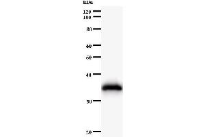 Image no. 1 for anti-Histidyl-tRNA Synthetase (HARS1) antibody (ABIN933100)