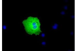 Image no. 4 for anti-Peroxisomal Biogenesis Factor 5 (PEX5) antibody (ABIN1500156)