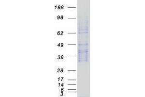 Image no. 1 for serine Peptidase Inhibitor, Kunitz Type, 2 (SPINT2) protein (Myc-DYKDDDDK Tag) (ABIN2732602)