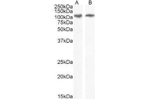 Image no. 1 for anti-Endoplasmic Reticulum To Nucleus Signaling 1 (ERN1) (Internal Region) antibody (ABIN308413)