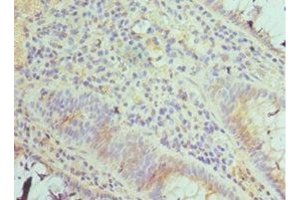 TAB1 antibody  (AA 205-504)