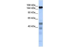 WB Suggested Anti-ZNF335 Antibody Titration:  0.