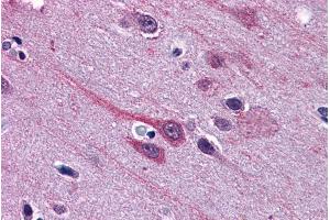 Image no. 3 for anti-Gastrulation Brain Homeo Box 2 (GBX2) (Internal Region) antibody (ABIN334408)