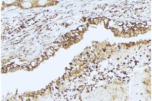 Image no. 1 for anti-Peroxisomal Biogenesis Factor 14 (PEX14) (Internal Region) antibody (ABIN6259331)