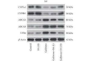 Image no. 1 for anti-ATP-Binding Cassette, Sub-Family G (WHITE), Member 5 (ABCG5) antibody (ABIN6136382)