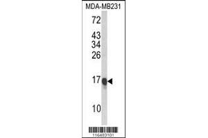 Image no. 3 for anti-Caveolin 2 (CAV2) (AA 11-44), (N-Term) antibody (ABIN652586)