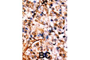 Image no. 1 for anti-Nuclear Factor kappa B (NFkB) (pSer536) antibody (ABIN3001768)