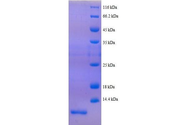 Peptide YY Protein (PYY) (AA 31-64, full length) (His tag)