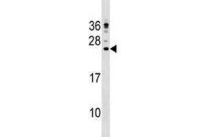 Image no. 1 for anti-Cathelicidin Antimicrobial Peptide (CAMP) (AA 123-152) antibody (ABIN3028580)