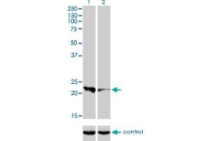 Image no. 1 for anti-Calcyphosine (CAPS) (AA 1-109) antibody (ABIN560163)