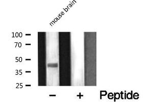 Image no. 2 for anti-Vacuolar Protein Sorting 72 Homolog (S. Cerevisiae) (VPS72) (Internal Region) antibody (ABIN6258354)