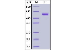 Image no. 1 for CD7 (CD7) (AA 26-180) (Active) protein (Fc Tag) (ABIN6950992)