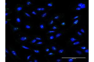 Image no. 1 for anti-Zinc Finger Protein 100 (ZNF100) (AA 99-206) antibody (ABIN1327221)