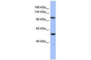 Image no. 1 for anti-Zinc Finger Protein, Multitype 1 (ZFPM1) (AA 935-984) antibody (ABIN6742928)