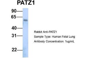Image no. 4 for anti-Zinc Finger Protein 278 (ZNF278) (N-Term) antibody (ABIN2779693)
