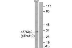 anti-Cyclin-Dependent Kinase Inhibitor 1C (p57, Kip2) (CDKN1C) (AA 267-316), (pThr310) antibody