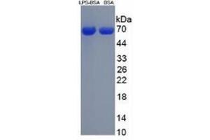 Image no. 2 for Lipopolysaccharides (LPS) ELISA Kit (ABIN6574100)
