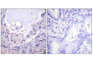 Image no. 4 for anti-V-Raf-1 Murine Leukemia Viral Oncogene Homolog 1 (RAF1) (Ser621) antibody (ABIN1847970)