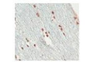 Image no. 1 for anti-SRY (Sex Determining Region Y)-Box 10 (SOX10) (Middle Region) antibody (ABIN2777864)