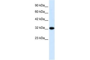 Image no. 1 for anti-Zinc Finger and BTB Domain Containing 32 (ZBTB32) antibody (ABIN2460305)
