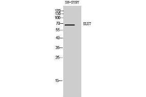 Image no. 1 for anti-SLU7 Splicing Factor Homolog (SLU7) (Internal Region) antibody (ABIN3186980)
