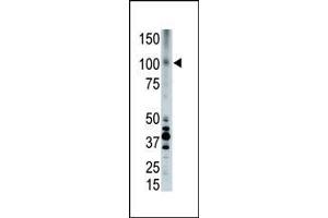 Image no. 1 for anti-Low Density Lipoprotein Receptor-Related Protein 8, Apolipoprotein E Receptor (LRP8) (AA 934-963), (C-Term) antibody (ABIN390101)
