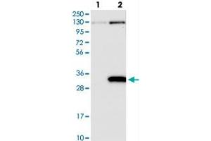 Image no. 2 for anti-Prune Homolog 2 (PRUNE2) antibody (ABIN5586283)