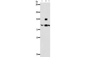 Image no. 3 for anti-ArfGAP with GTPase Domain, Ankyrin Repeat and PH Domain 1 (AGAP1) antibody (ABIN2426527)