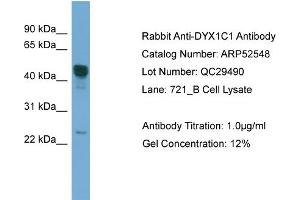 Image no. 1 for anti-Dyslexia Susceptibility 1 Candidate 1 (DYX1C1) (Middle Region) antibody (ABIN2784980)