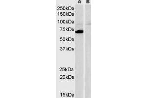 Image no. 1 for Monoamine Oxidase A (MAOA) peptide (ABIN368822)