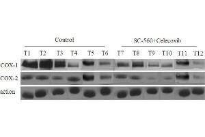 Image no. 8 for anti-Prostaglandin-Endoperoxide Synthase 2 (Prostaglandin G/H Synthase and Cyclooxygenase) (PTGS2) (AA 501-604) antibody (ABIN672471)
