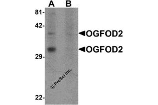 OGFOD2 Antikörper  (Middle Region)