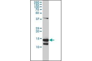 Image no. 1 for anti-CD247 Molecule (CD247) (AA 1-165) antibody (ABIN782349)