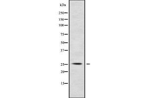 Image no. 1 for anti-Polymerase (RNA) III (DNA Directed) Polypeptide G (32kD) (POLR3G) (N-Term) antibody (ABIN6264822)
