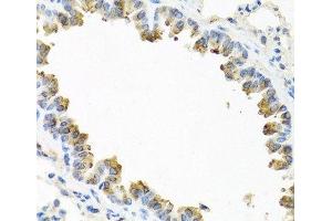 Immunohistochemistry of paraffin-embedded Mouse lung using TICAM1 Polyclonal Antibody at dilution of 1:100 (40x lens).