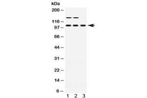 Image no. 2 for anti-Actinin, alpha 3 (ACTN3) (AA 574-617) antibody (ABIN5647038)